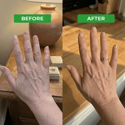 LINEA - Lymphatic Drainage